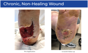 Hidden Signs of Poor Circulation That Show Up on the Skin Before a Wound Forms